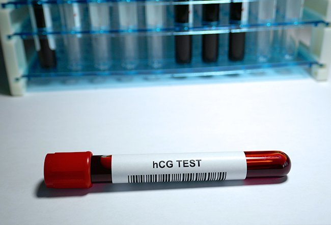 A positive beta hCG levels means that you are pregnant. The hCG level depends on how far along a woman is in her pregnancy.