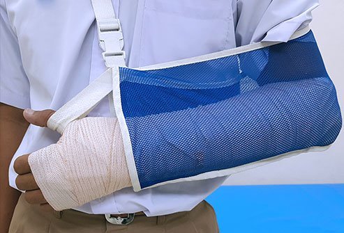 An ulnar gutter splint is a flexible splint that is used to support, stabilize, and immobilize injuries, dislocations and fractures of the hands, fingers, or wrists.