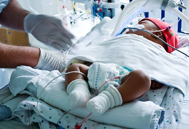 campomelic dysplasia (CMD)