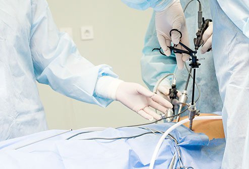 What Is Operative Laparoscopy?