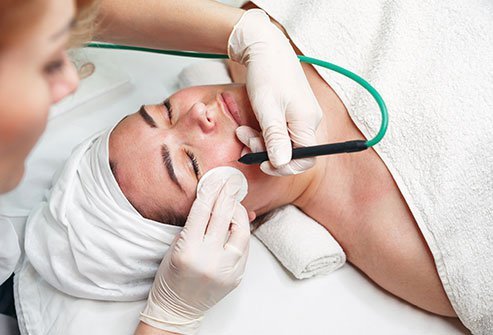 Electrocautery is a procedure in which an electric current is passed through a resistant metal wire