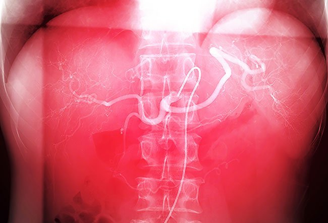 A tumor requires a continuous blood supply to grow and survive.