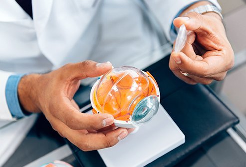 Optic nerve sheath meningioma is a nonaggressive and slow growing tumor in the eye.