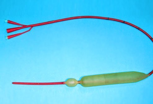 Sengstaken-Blakemore tube