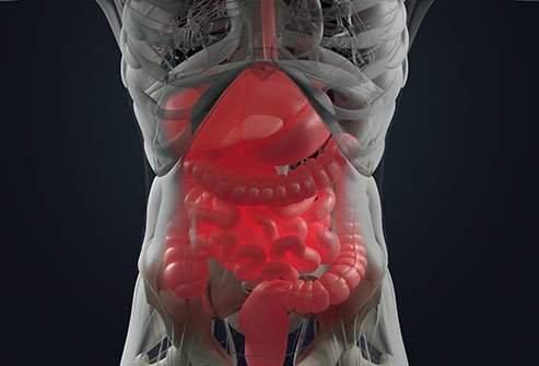 Ulcerative Colitis