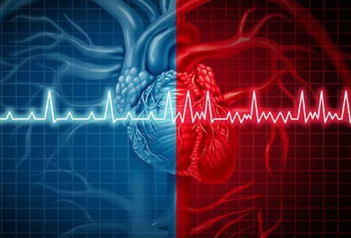 Atrial fibrillation (AF)