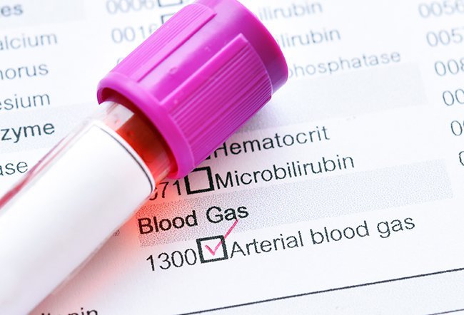 Blood gas analysis measures the levels of oxygen, carbon dioxide, and bicarbonate in the blood as well as the pH level and oxygen saturation. The normal range for blood gases is shown in the table.