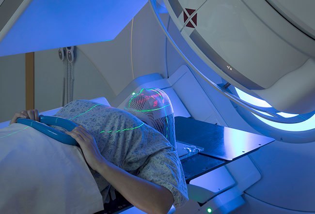 Diffuse intrinsic pontine glioma (DIPG) is an aggressive type of childhood cancerous tumor