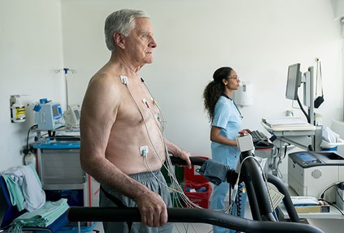 During the treadmill stress test, your heart rate, blood pressure, and electrocardiograph (ECG) are monitored.