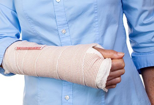 Volar splints minimize movements and provide support and comfort by stabilizing an injury of the palm or foot, which also reduces pain and helps the injury heal faster.