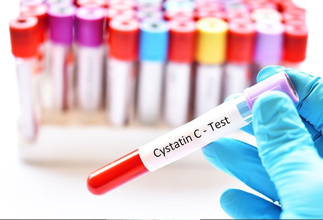 Blood urea nitrogen (BUN) is one of the parameters measured to ascertain kidney function. BUN indicates the urea nitrogen produced in the body during protein breakdown. There is no definite value of BUN that would diagnose kidney failure.