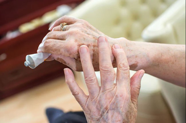 Age spots and wrinkles are no surprise, but you may also find that you bruise more and sweat less.