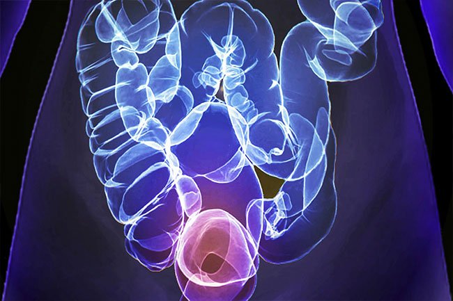 what-to-expect-with-a-colonoscopy-s14-ct-scan-virtual-colonoscopy.jpg