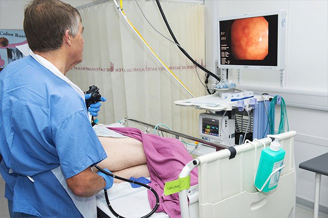 You'll lie on your side while the doctor inserts the colonoscope to visualize your colon.