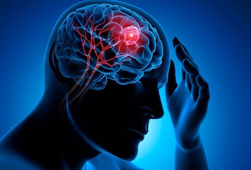 What Are the Symptoms of ATRT