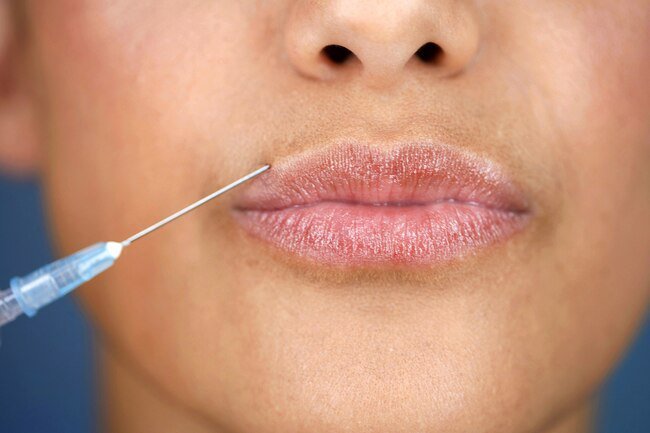 Several different types of synthetic fillers are available.