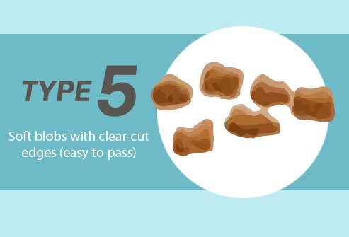 These are easy to pass, but you may feel a sense of urgency about getting to the bathroom.