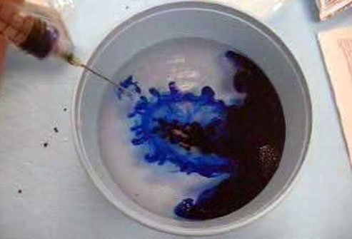 Intra-articular Methylene Blue Injection
