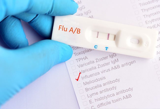 rapid influenza diagnostic tests