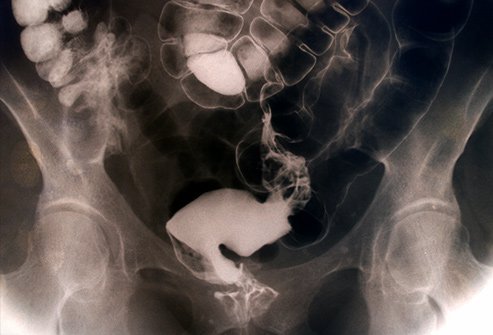 See your doctor to rule out potentially serious health problems.