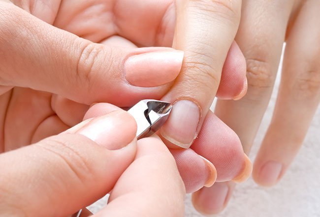 Hangnails are often seen at the end of a digit near the nail.