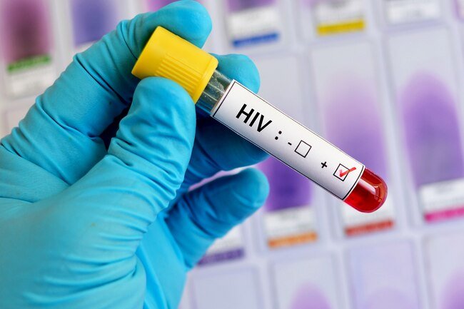 Several viral and bacterial infections can damage your nerves and cause numbing or stabbing sensations in your hands and feet.