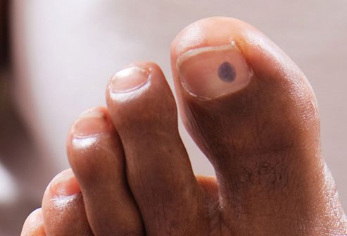 If you stub your toe and it turns blue, you might not think twice about the color.