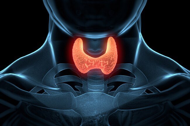 You may get chills as a result of an underactive thyroid.