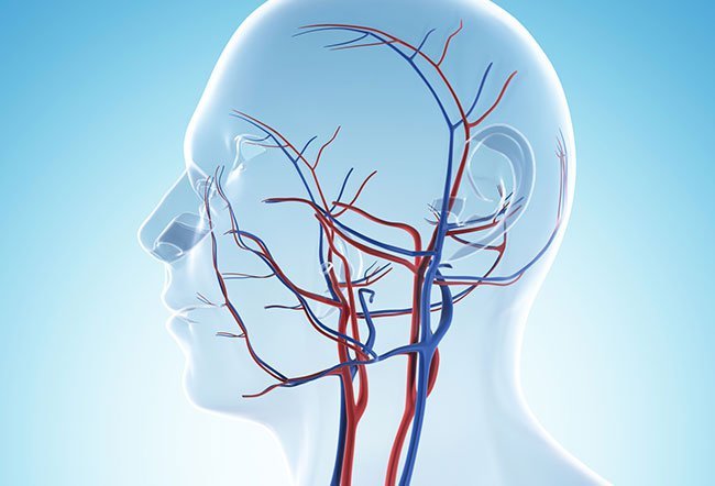 Temporal artery biopsy (TAB)
