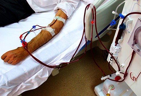 Too much potassium can lead to muscle weakness, irregular heartbeat, and nausea.