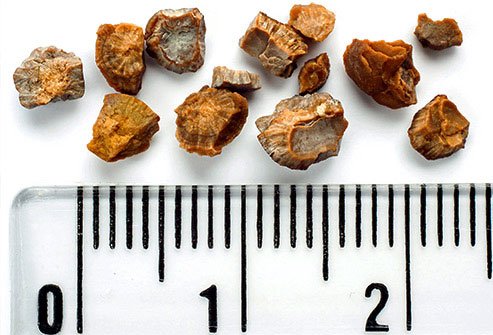 Foods with potassium may help prevent kidney stones.