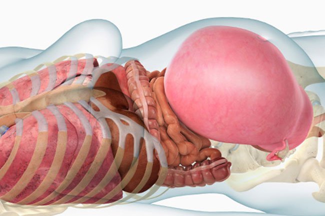 Moms-to-be are likely to snore because their nasal passages can swell.