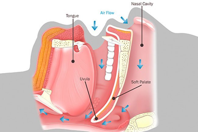 The shape of your mouth can make you snore.