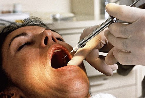 Your dentist can perform a simple extraction inside the office.