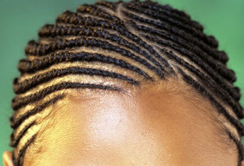 Prevent hair loss in women by avoiding tight hair styles that pull on hair.