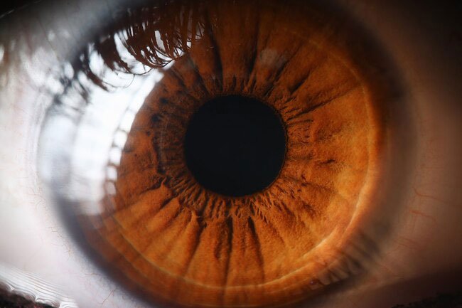 About 250 million people around the world have mild to serious vision loss.