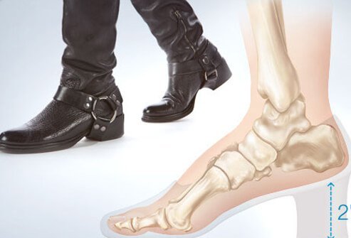 Photo of lower heels.