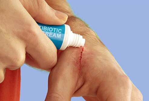 Should you apply ointment or cream to cover cuts and scrapes on the skin?