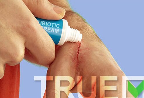 Do use cream for cuts and scrapes to keep them moist.