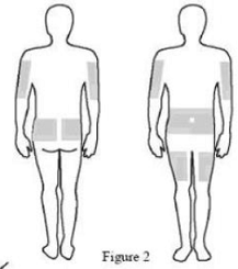 Select the number and location of injection sites.
Rotate sites for each administration - Illustration