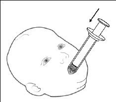 Give the mixture to the child right away - Illustration