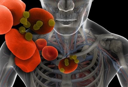 Can bacteria in your mouth contribute to heart disease and stroke?