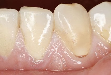 Anemia can make your skin pale. But pale skin may also be harmless.