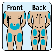 Injection site and expose skin - Illustration