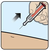 Remove the needle - Illustration