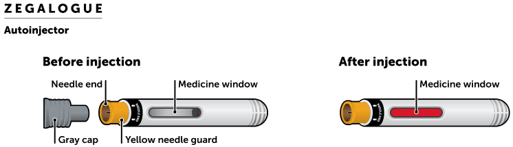 Autoinjector - Illustration