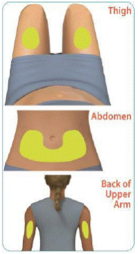 Choose and clean your injection site - Illustration