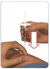 Use a quick dart-like motion and insert the needle at a 90° angle into your skin - Illustration