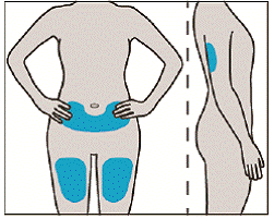 Choose and clean your injection site - Illustration