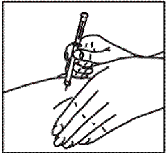 With your free hand, pinch the skin around the site with the thumb and forefinger of the other hand - Illustration